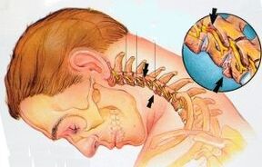 Cervical Saila