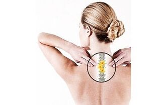 Trápaga osteokondrosia emakume batean