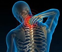 bizkarrezurra zerbikalaren osteokondrosia