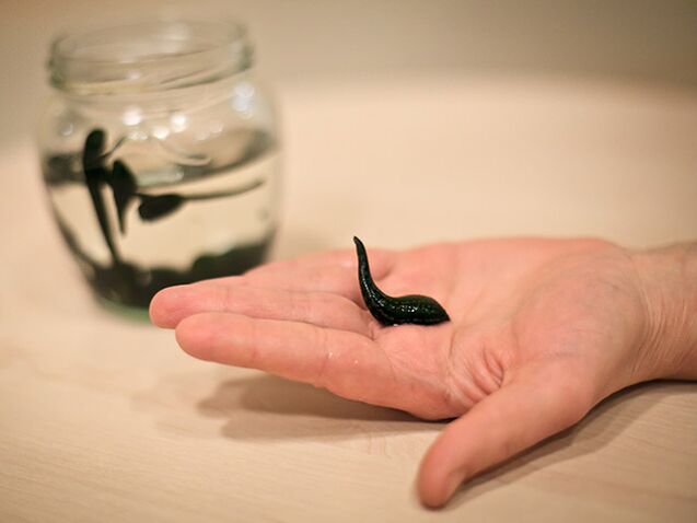 belauneko artikulazioaren artrosiaren tratamendurako aplikazioa