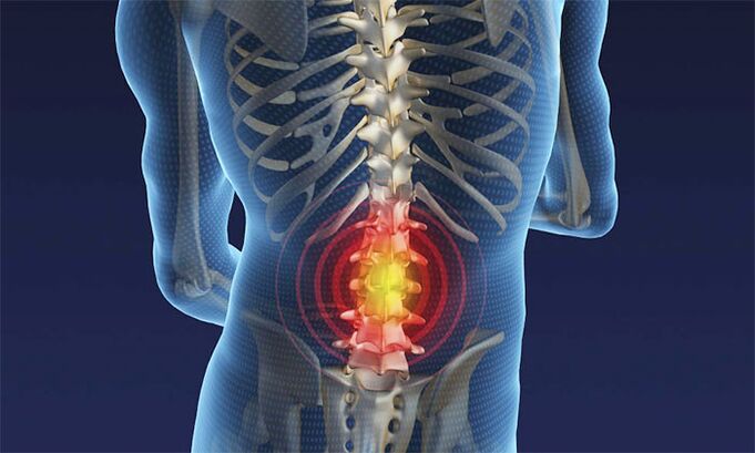 mina lumbar eskualdean